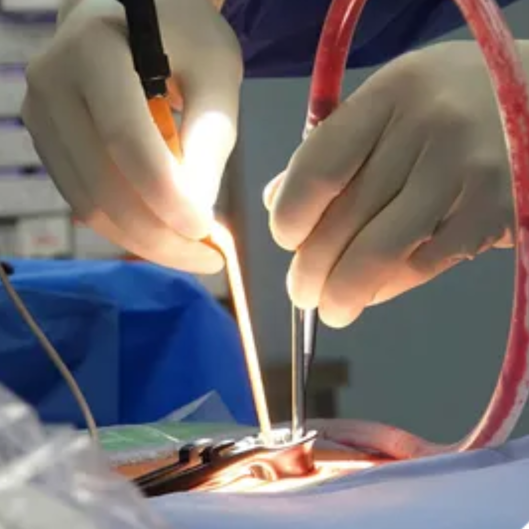 Surgical site infections