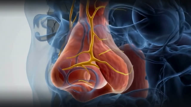 Septoplasty — surgery for a deviated nasal septum