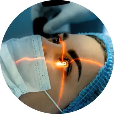 Femtosecond Laser-Assisted Cataract Surgery (FLACS)