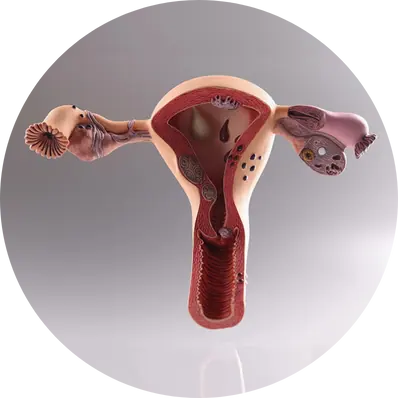 Abnormal uterine bleeding