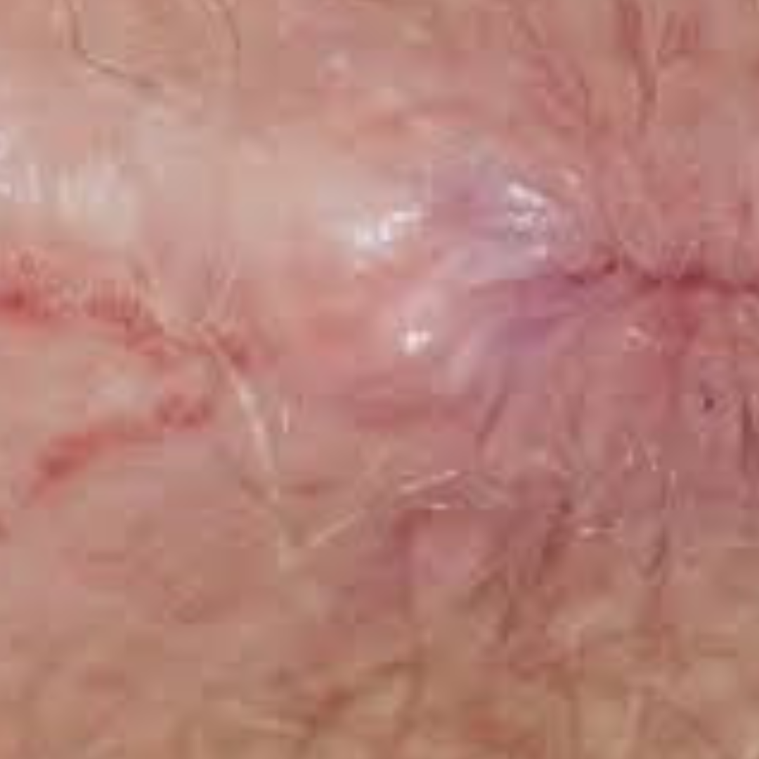 Visible tear near the anus