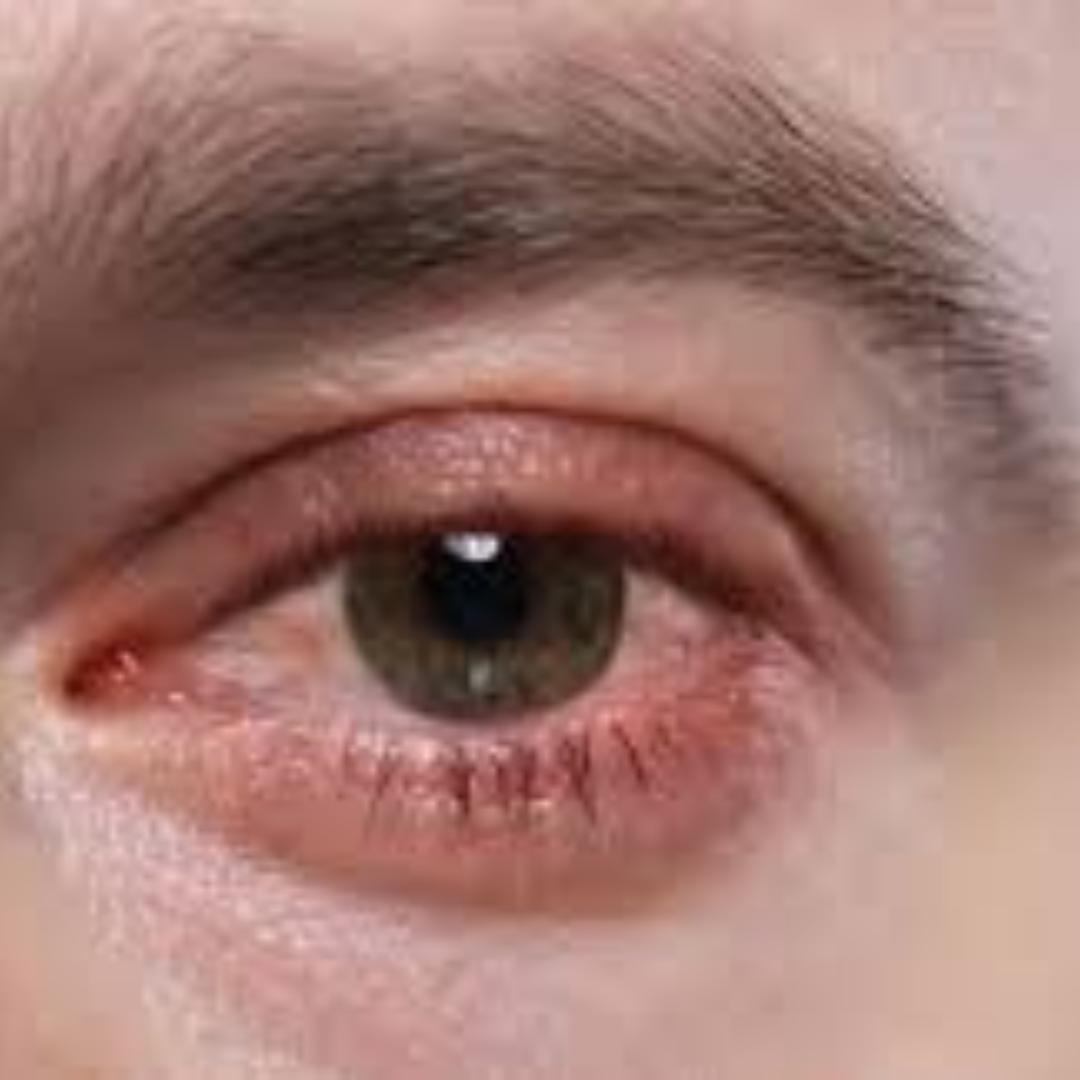 Sudden drop in vision