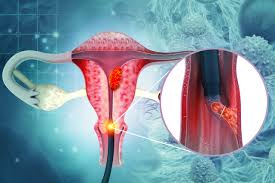 To diagnose endometrial conditions