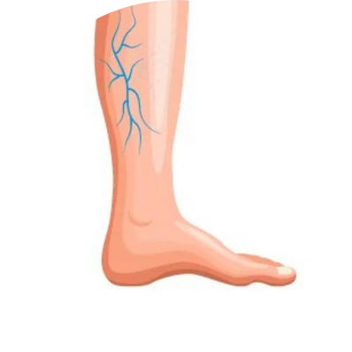Reticular Veins