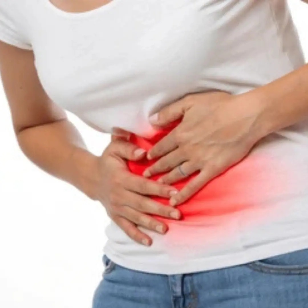 Recurrent urinary tract infections (UTIs) due to obstruction