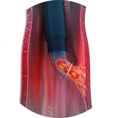 To diagnose endometrial conditions