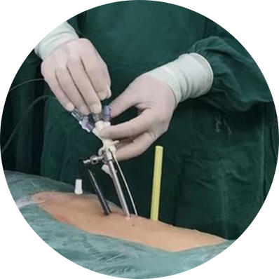 Micro-PCNL