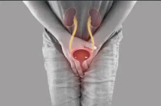 Recurrent urinary infections