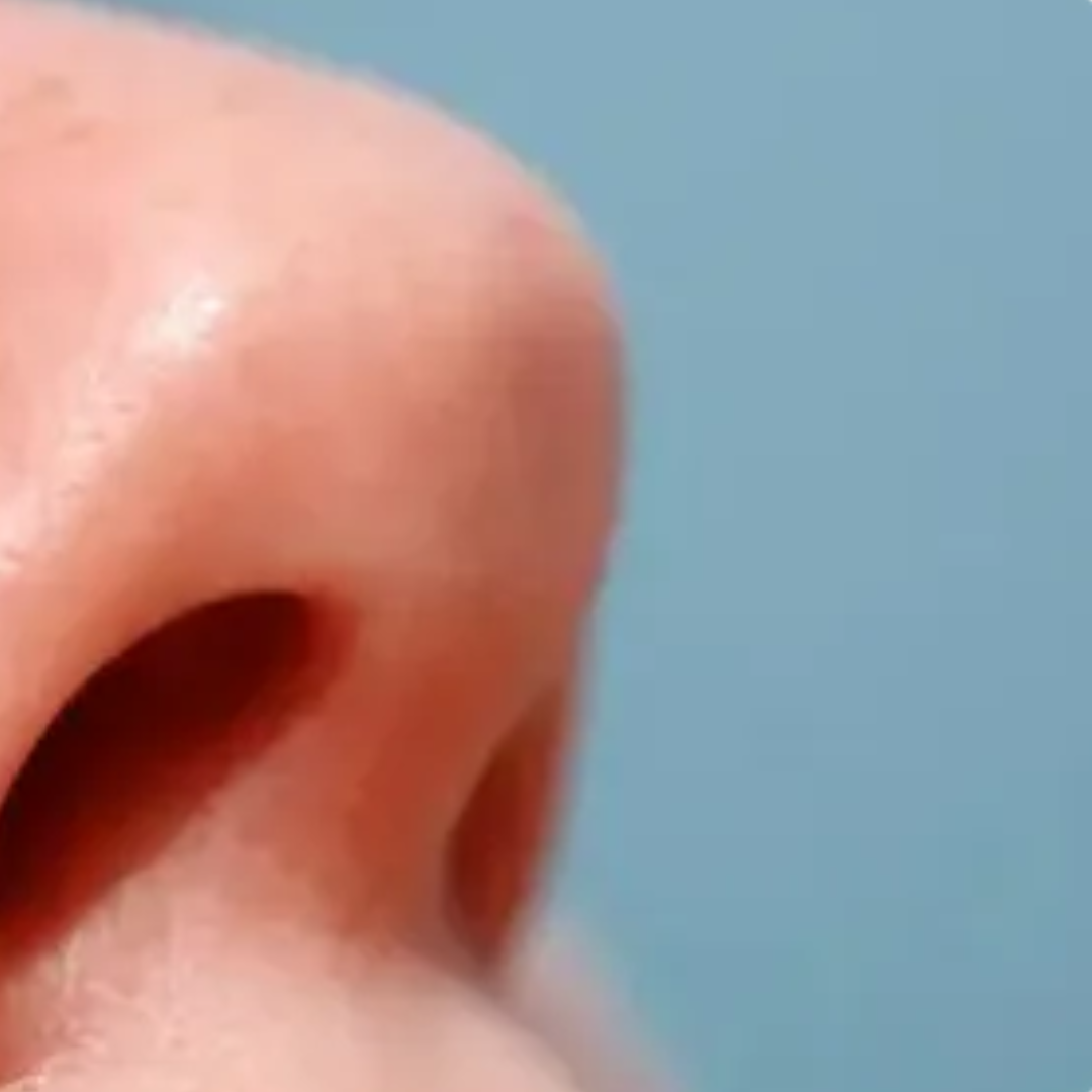 Crepitus