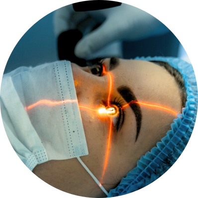 Femtosecond Laser-Assisted Cataract Surgery (FLACS)