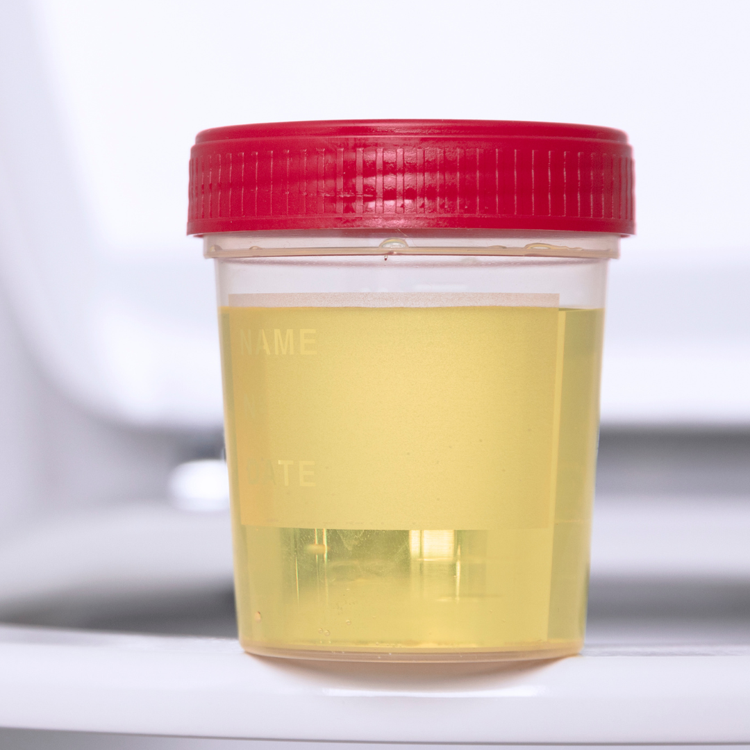 Weak or interrupted urine stream