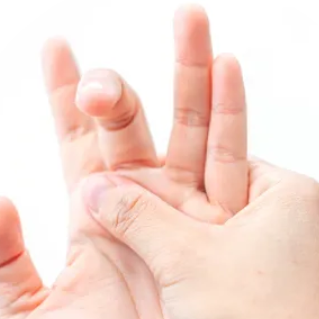 Finger locked in a bent position temporarily or permanently