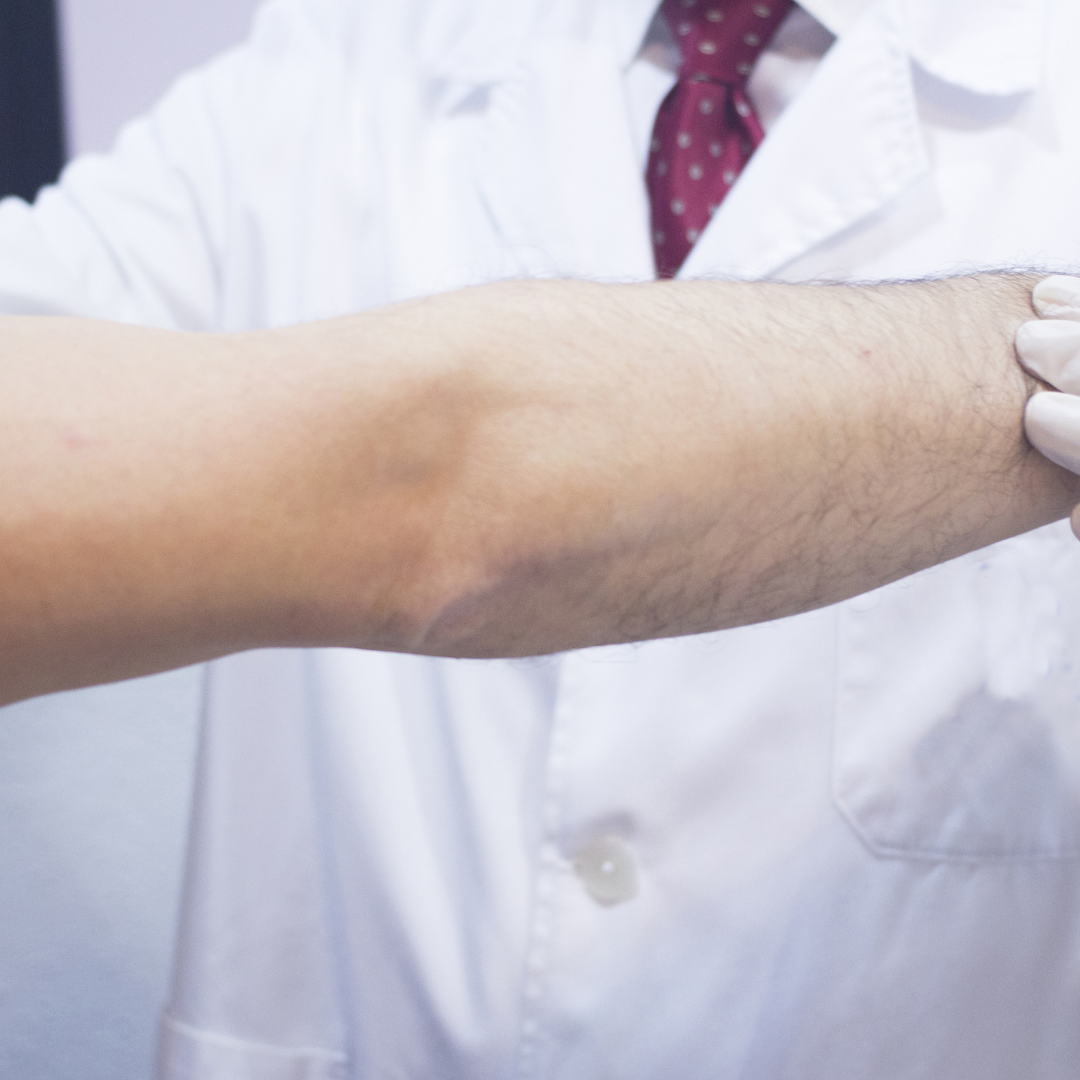 Visible deformity or abnormal angulation of the arm