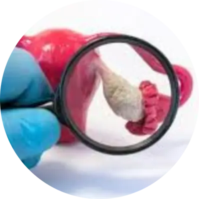 Unilateral Cystectomy