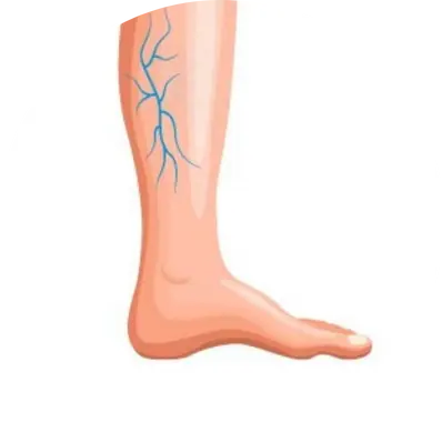 Reticular Veins