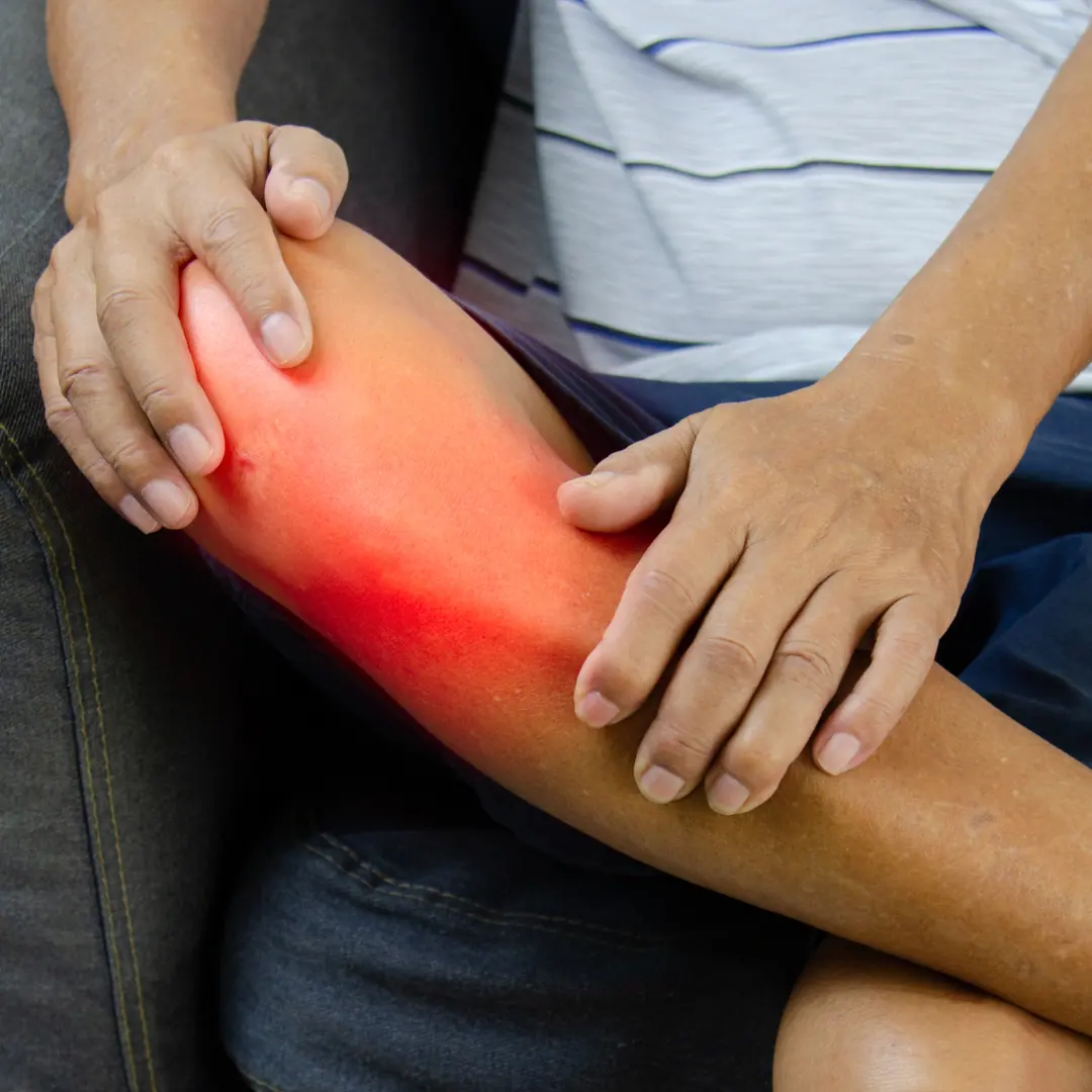 Leg cramps while standing up