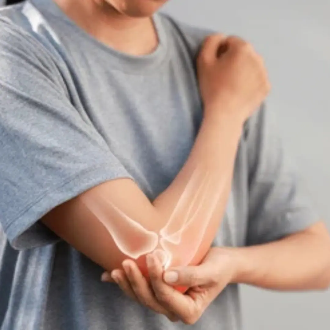 Severe joint pain that limits daily activities