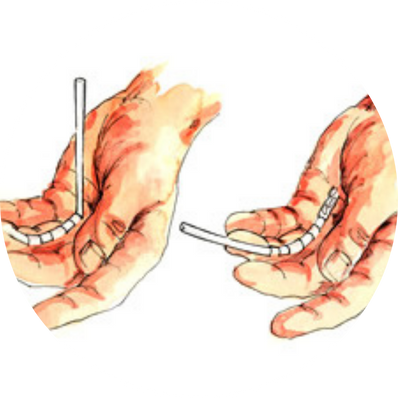 Tendon Grafting