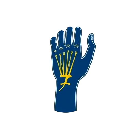 Median nerve compression at wrist