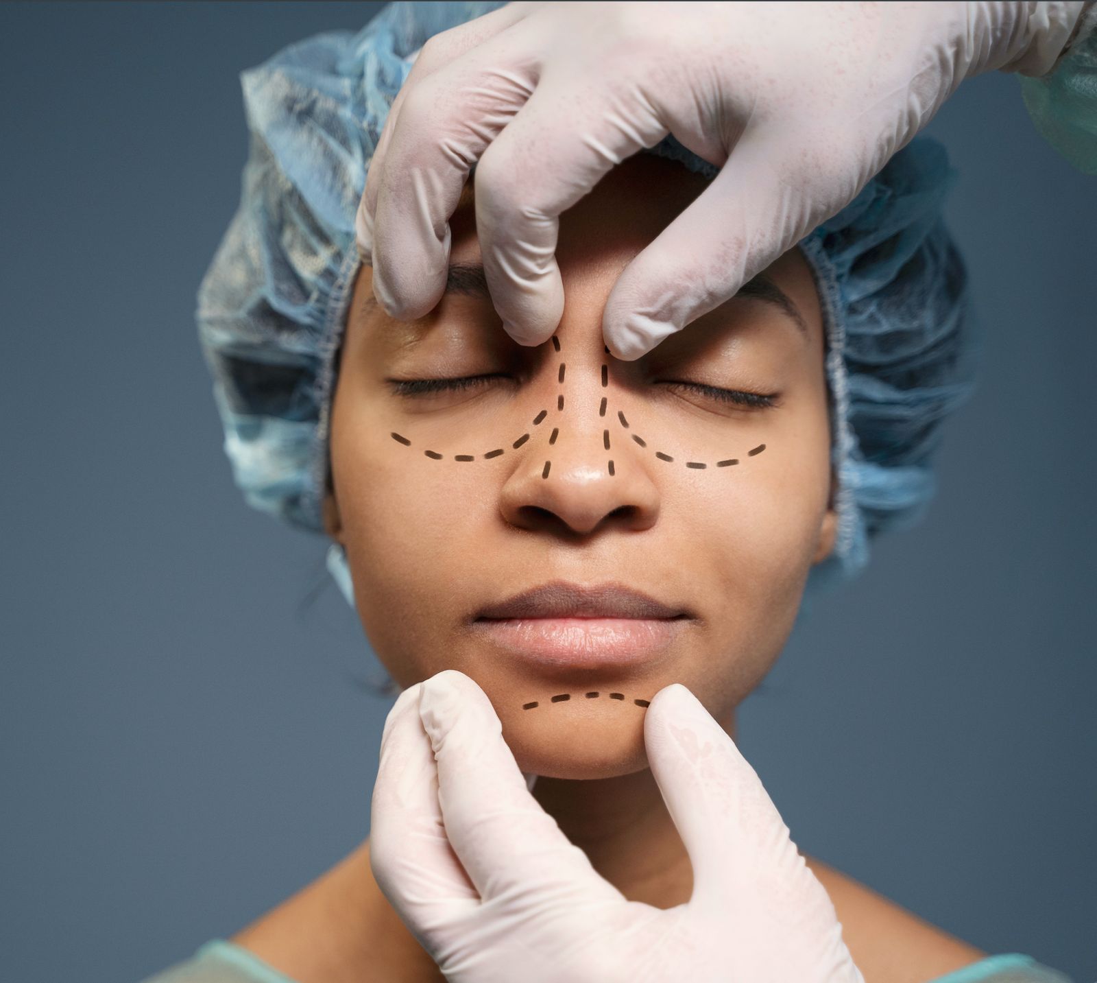 Septoplasty