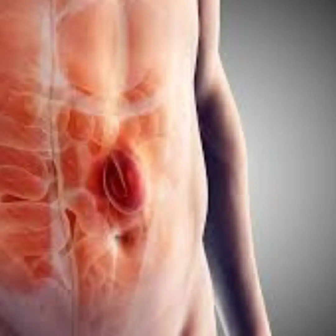 Sudden painful irreducible swelling